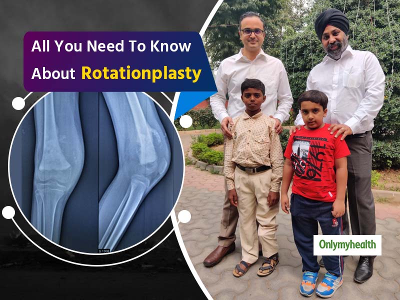 Rotationplasty: A Ray of Hope For Kids With Lower Limb Bone Cancers